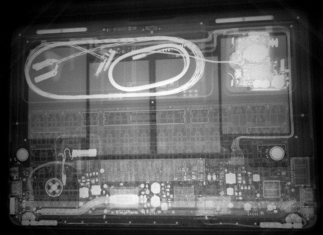 xray