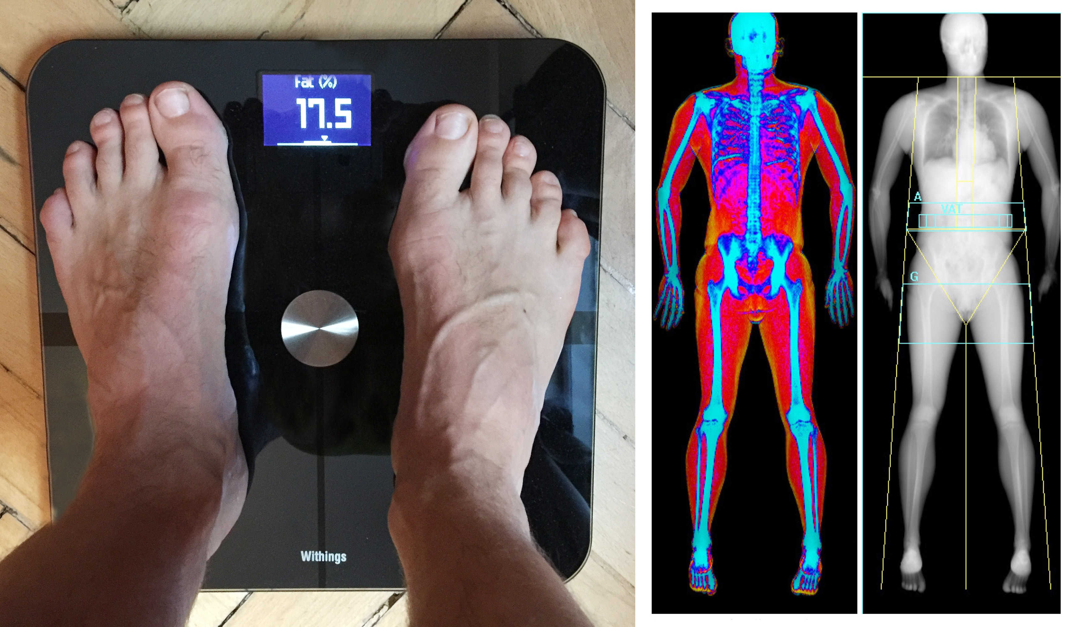 Withings Smart Body Analyzer (left) vs. DEXA, the 