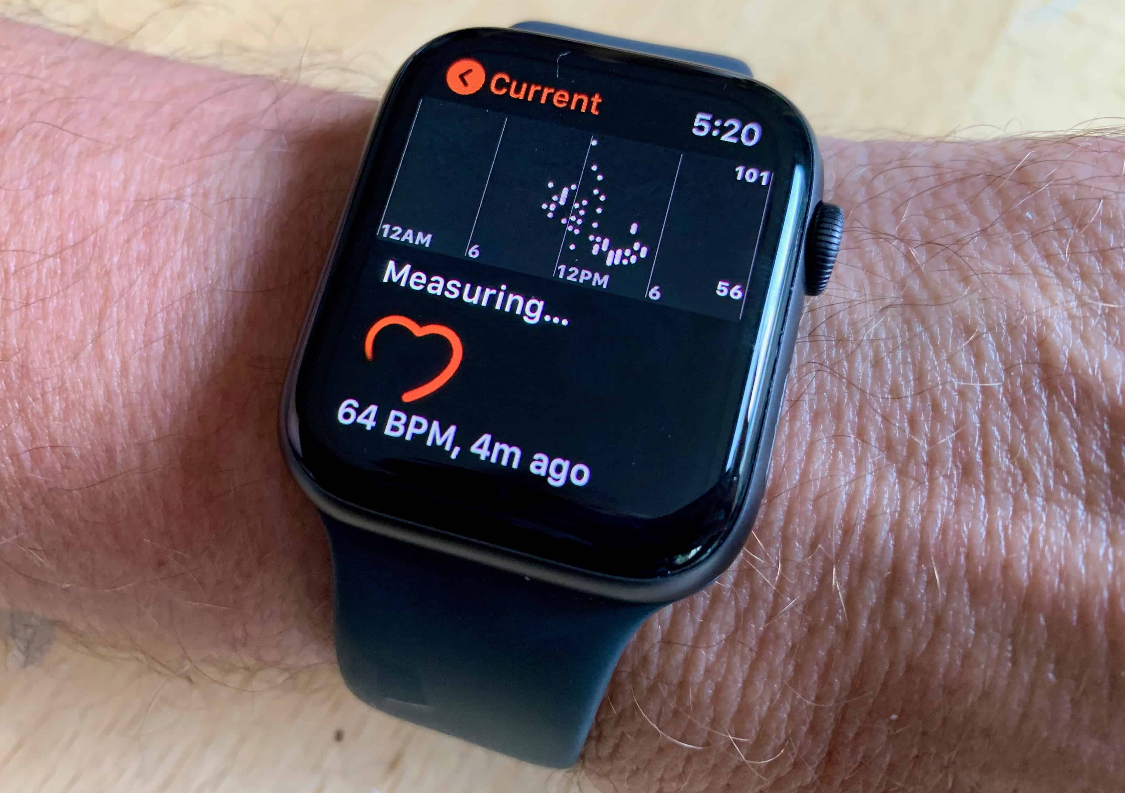 Apple Watch's EKG tech may have helped save yet another life