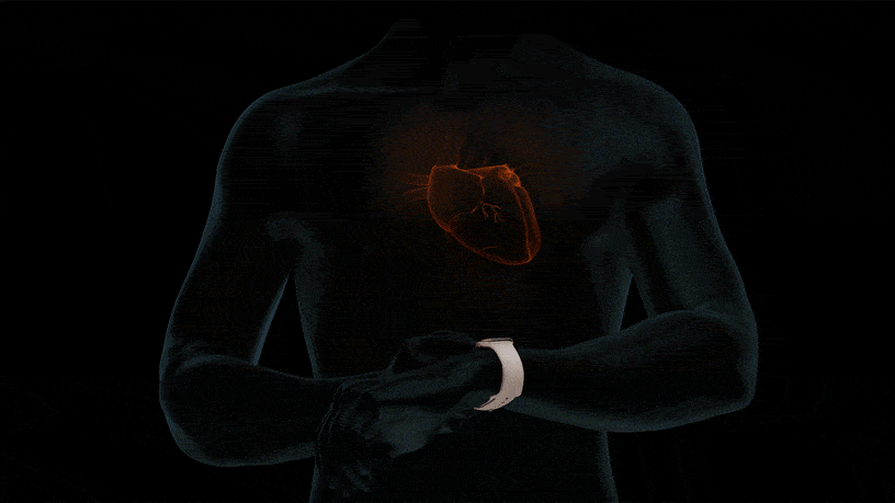 Apple Watch ECG