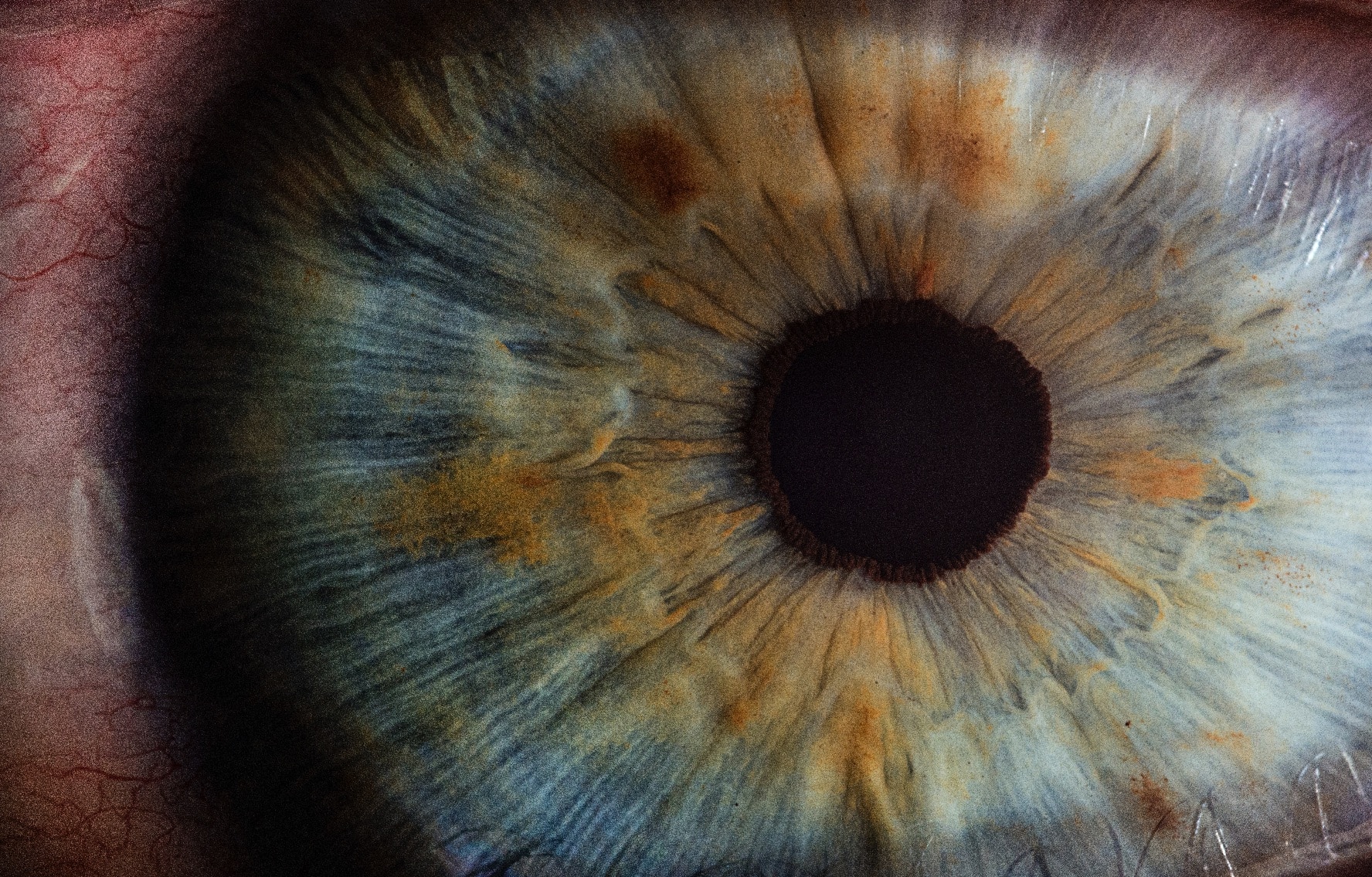 Eye closeup