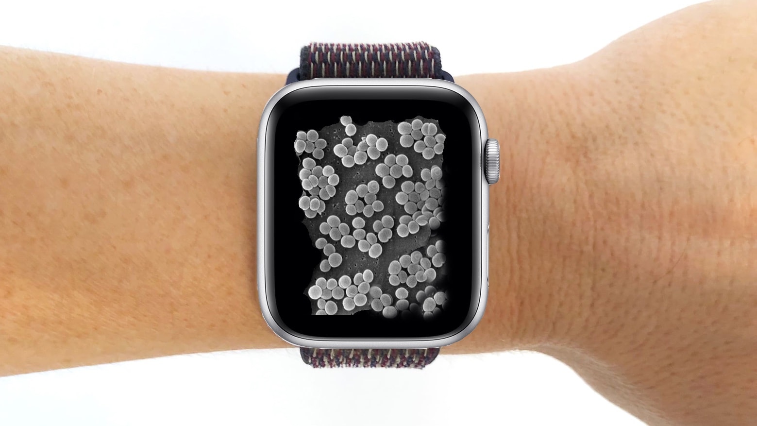 Clean your filthy Apple Watch bands, people