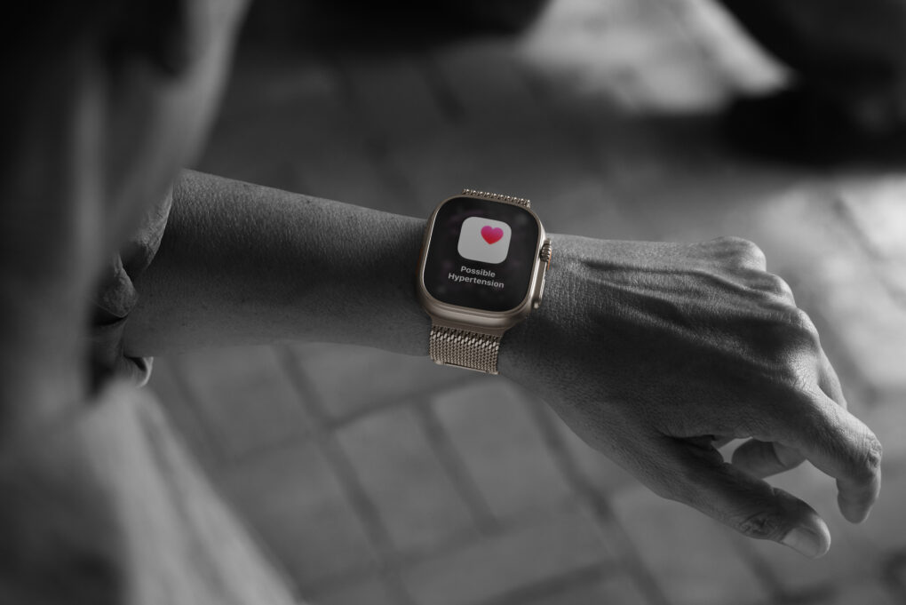 Hypertension detetction on Apple Watch